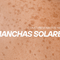 Las manchas solares: por qué aparecen y cómo prevenirlas este verano