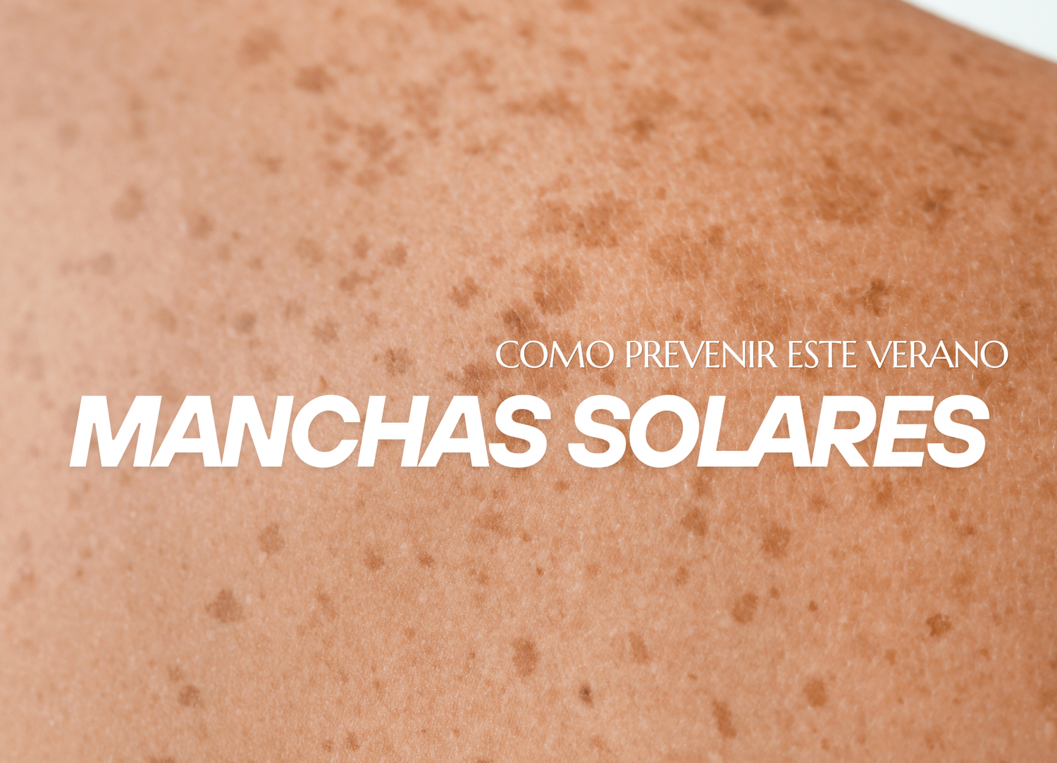 Las manchas solares: por qué aparecen y cómo prevenirlas este verano